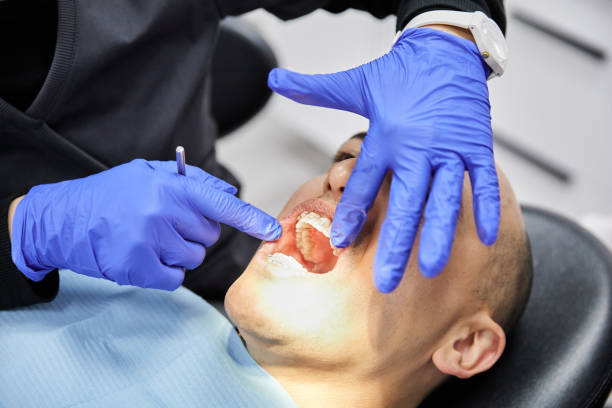 Best Emergency Treatment for Oral Infections in Viera East, FL